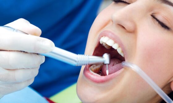 Dental Care Explained