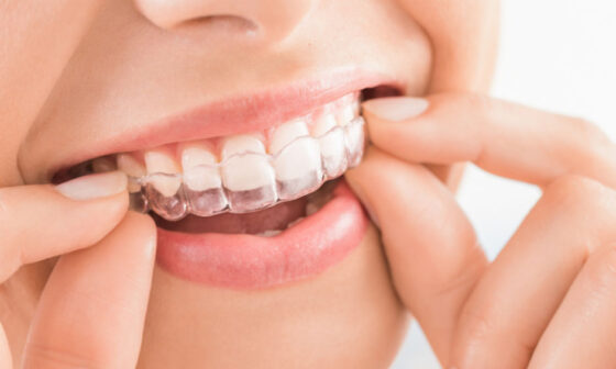 How Orthodontic Technology Improves Braces Treatment in Kelowna