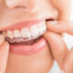 How Orthodontic Technology Improves Braces Treatment in Kelowna