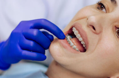 What Patients Overlook Before Starting Orthodontic Treatment in Las Vegas