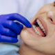 What Patients Overlook Before Starting Orthodontic Treatment in Las Vegas