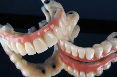 Sustainable Solutions for Full Arch Restoration