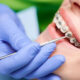 Tips for Maintaining Oral Hygiene with Braces in Winnipeg
