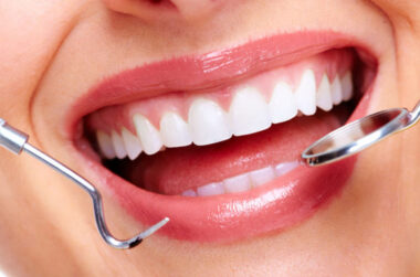 What Problems Can a Cosmetic Dentist in Edison Fix Beyond Just Aesthetics