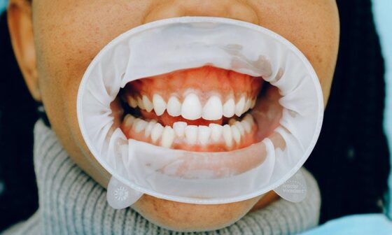 Common Dental Issues That Require Professional Attention