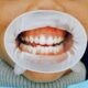 Common Dental Issues That Require Professional Attention