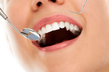 The Essentiality Of Choosing a Dentist in Maple Ridge Who Offers Insurance Facilities