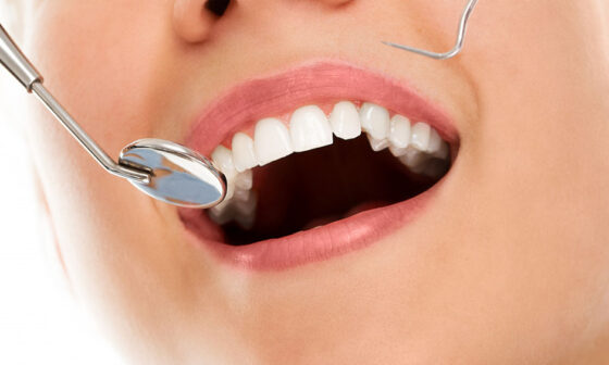 The Essentiality Of Choosing a Dentist in Maple Ridge Who Offers Insurance Facilities