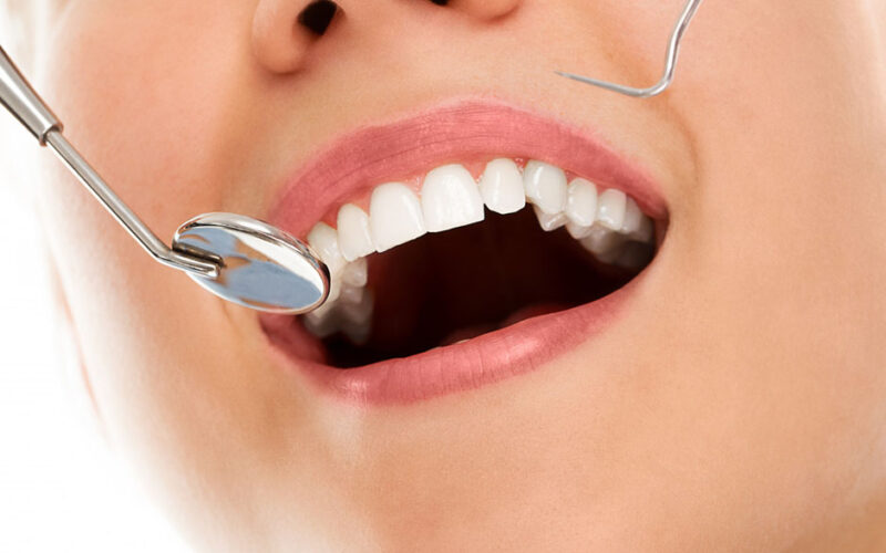 The Essentiality Of Choosing a Dentist in Maple Ridge Who Offers Insurance Facilities