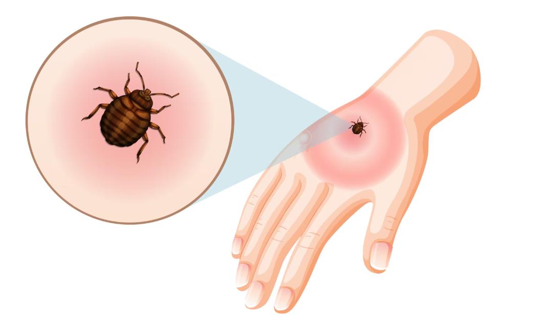 What Should You Do If You Find Bed Bugs 2