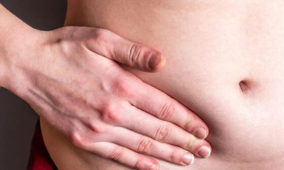What You Need to Know About Hernia Treatment Options