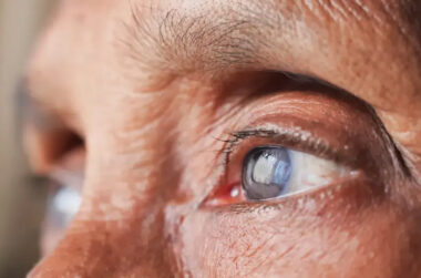 Signs Your Eye Is Healing Normally After Cataract Treatment
