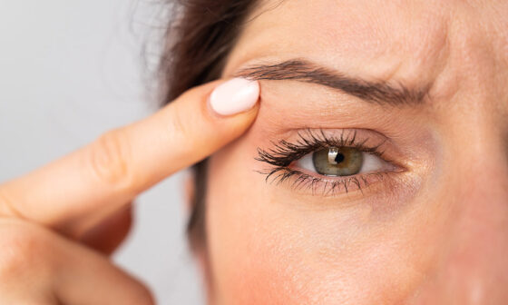 Understanding the Benefits and Limits of Eyelid Surgery