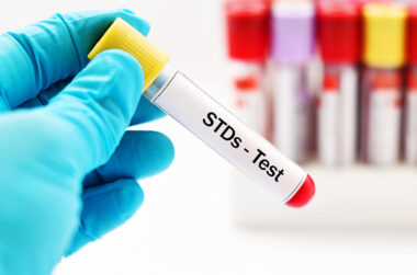 std testing