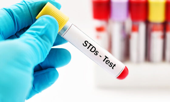 std testing