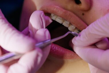 A Beginners Guide to Modern Orthodontic Treatment Options