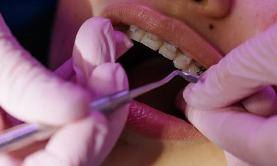 A Beginners Guide to Modern Orthodontic Treatment Options
