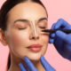 Rhinoplasty