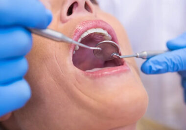 Why Early Dental Evaluation Can Reduce Complex Oral Surgery in Kelowna