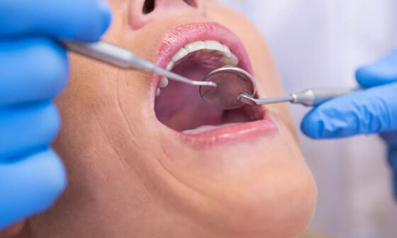 Why Early Dental Evaluation Can Reduce Complex Oral Surgery in Kelowna