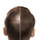 Why Wider Frontals Are Changing How Stylists Approach Hairlines