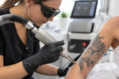Comprehensive Tattoo Removal Training Program