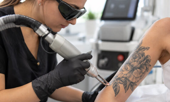 Comprehensive Tattoo Removal Training Program