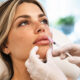 How to Think About Lip Fillers Before You Book