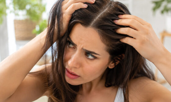 Uncovering The Hidden Culprit Behind A Flaking Scalp