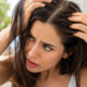 Uncovering The Hidden Culprit Behind A Flaking Scalp