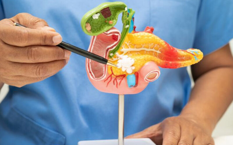 How Bile Leaks After Gallbladder Surgery Can Affect A Medical Malpractice Claim