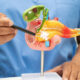 How Bile Leaks After Gallbladder Surgery Can Affect A Medical Malpractice Claim